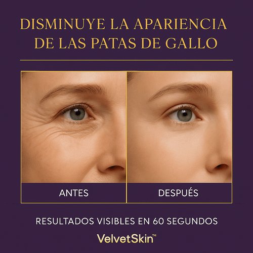 VelvetSkin™ Mirada Joven en solo 60 segundos