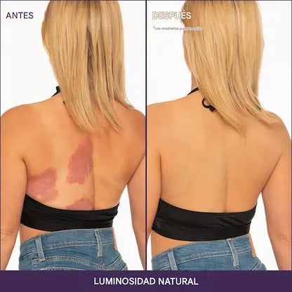 VelvetSkin™  Incluye aplicador profesional