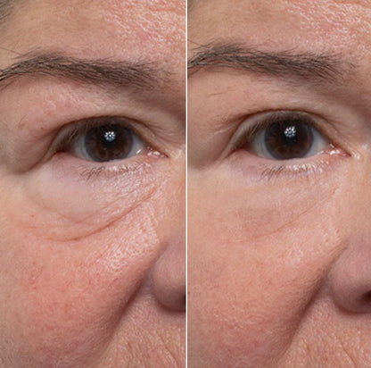 VelvetSkin™  Rejuvenece tu mirada  en 60 SEGUNDOS