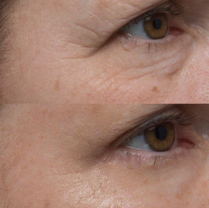 VelvetSkin™  Rejuvenece tu mirada  en 60 SEGUNDOS